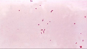 California health officials issue meningococcal disease advisory