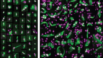 New test to predict heart attack