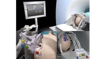 MRI-guided brain surgery easier on Parkinson’s patients