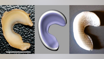 Torn knee joint? Don’t worry, this 3D-printed implant will help you grow a new one