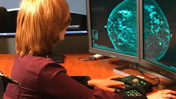 A better mammogram? Huge study putting 3-D scans to the test