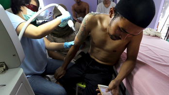 Indonesia clinic gives relief to Muslims with tattoo regrets