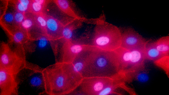 Lab test may identify dangerous gene mutations, study finds