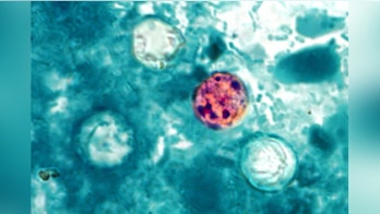 FDA says investigating latest cyclosporiasis outbreak