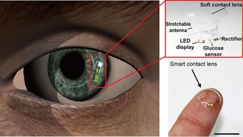 Smart contact lens helps diabetics monitor blood sugar levels