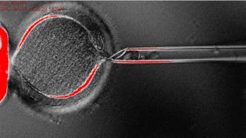 In medical breakthrough, scientists convert human skin cells into embryonic stem cells