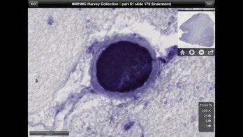 Einstein's brain is now an interactive iPad app