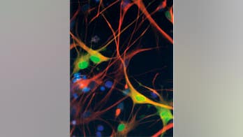 Family sues after boy is kicked out of school over his DNA