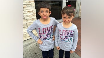 Burned Syrian children find treatment in Texas