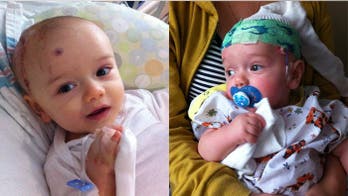 Neurosurgeon first in US to perform novel brain surgery on 1-year-old with epilepsy