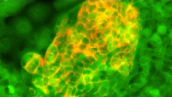 Novel stem cell technique may transform liver and pancreatic transplant therapies