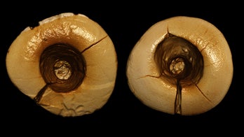 Earliest dental fillings discovered in 13,000-year-old skeleton