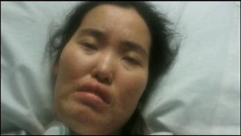 Woman who won right to die has change of heart, stays on life support