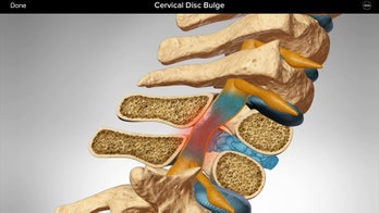 3D medical apps ease anxiety, hasten healing for surgical patients