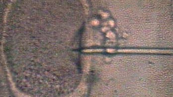 More evidence obesity may lower IVF success