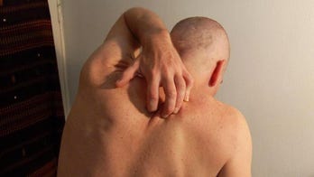 Why do we itch? Scientists seek to solve the maddening mystery