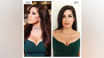 'Real Housewife of New Jersey' star Jacqueline Laurita opens up about plastic surgeries