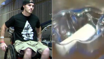 Doctors hope groundbreaking spinal cord surgery will help Arizona man walk again