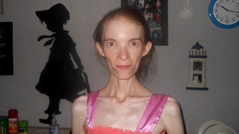 Anorexic woman is given choice to seek out-of-state medical treatment or die