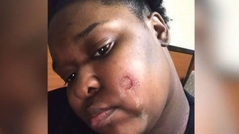 McDonald's worker shot in the face with paintball gun over broken drink machine