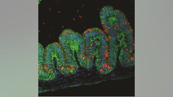 Tiny human stomachs grown in lab