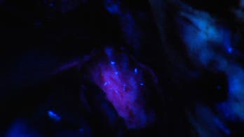 New technique 'lights up' brain tumor