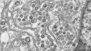 Saudi records 11 cases of MERS virus in Jeddah