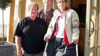 Rare Condition That Led to Leg Amputation Now Causing Stump to Grow