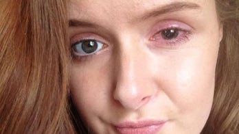 Woman spent 5 days in the dark after a contact lens tore her eye