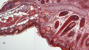 Spiny mouse can regrow skin