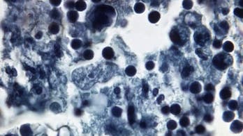 Brain-eating amoeba in water supply of New Orleans suburb could be linked to Hurricane Katrina