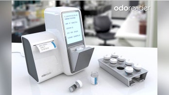 New 'scent machine' can help diagnose patients with bladder cancer
