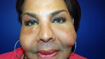 Illegal injections killing, maiming women seeking cheap alternative to plastic surgery