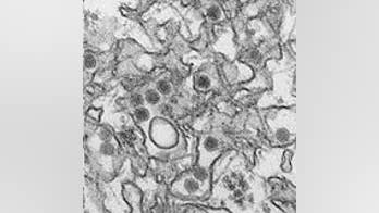 Scary Zika virus might be spread through sex, too