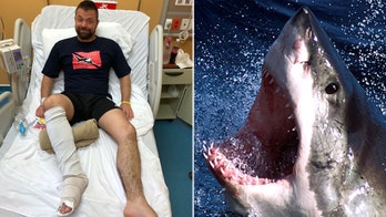 WARNING, GRAPHIC CONTENT: Man punches shark that was mauling his foot, exposing bones and tendons
