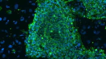 Stem cells help evaluate experimental Alzheimer's drugs