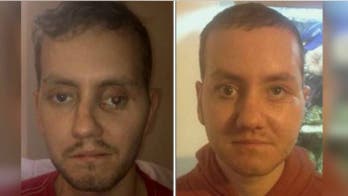 Man receives 3D-printed skull