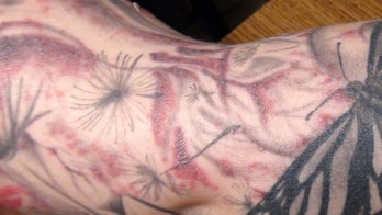 Tattoo infections linked to manufacturers' ink