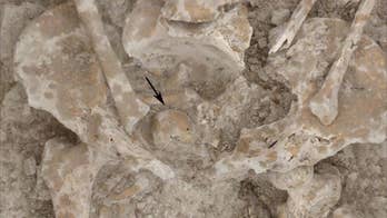 Toothy tumor found in 1,600-year-old Roman corpse