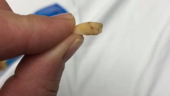 Human tooth found in bag of Planters cashews, woman says