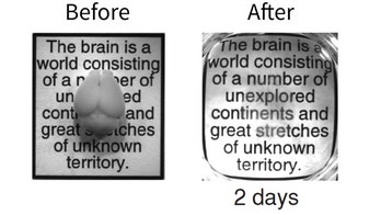 Let's make this perfectly clear: 'Stupendous' see-through mouse brains a new research tool