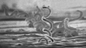 Origins of syphilis still a mystery, researchers say