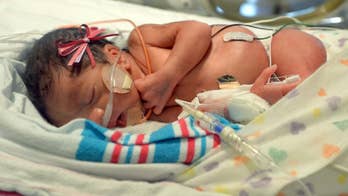 Central California hospital sees trio of triplets born in June with fourth set expected soon