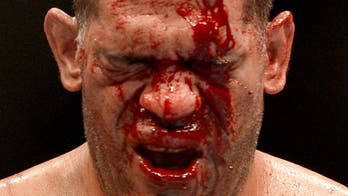 The good, bad & ugly in MMA this week highlight importance of regulation