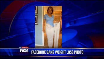 Facebook bans woman's weight loss photo