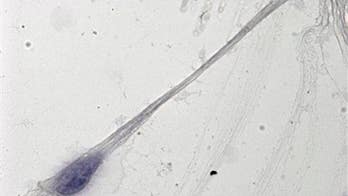 Your father's sperm could be making you fat