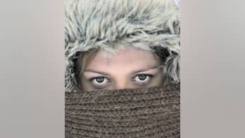 Moisturizers for Dry Winter Skin