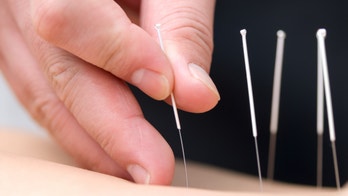 Can acupuncture treat women's health issues? Studies find mixed results