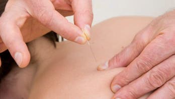 Tailored acupuncture might offer some fibromyalgia relief