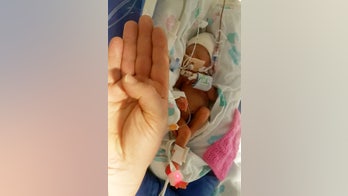 'Miracle' baby who weighed under 2 pounds thriving 6 months later